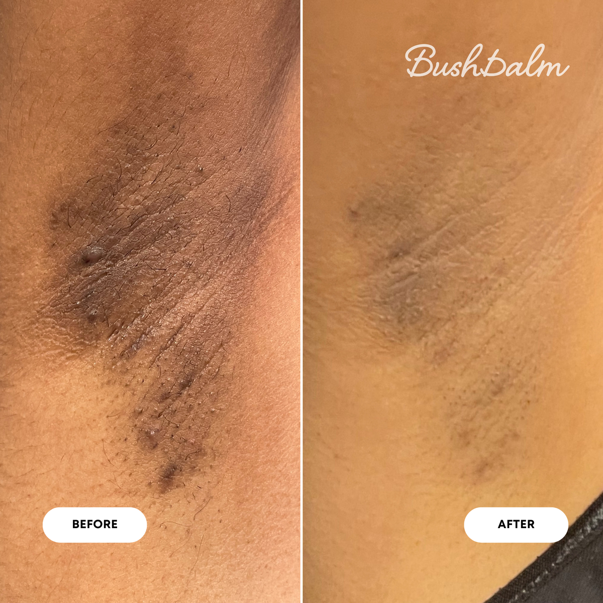 2-Step Dark Spot Routine - Bermuda S0