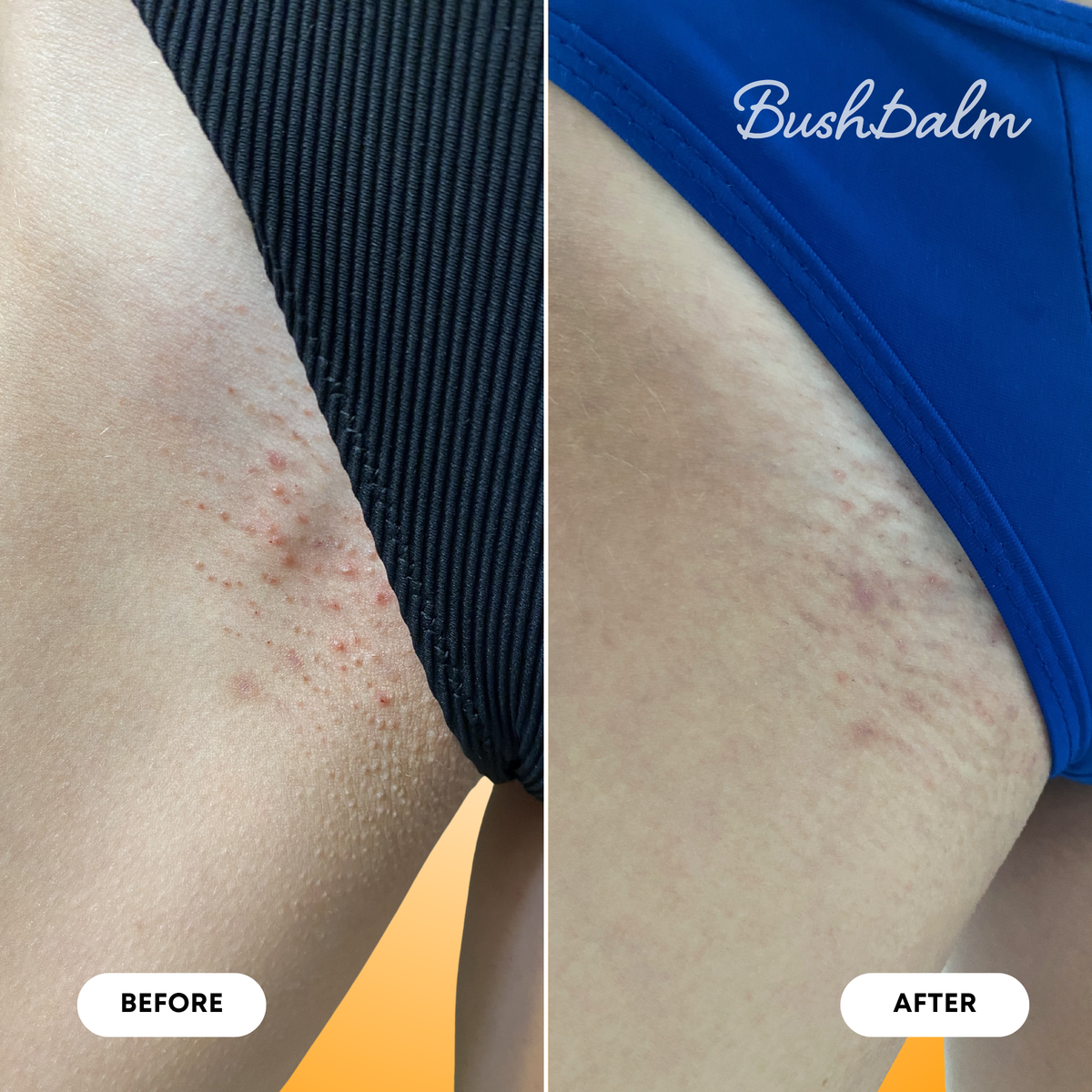 2-Step Ingrown Hair Routine - Vanilla Tangerine D5