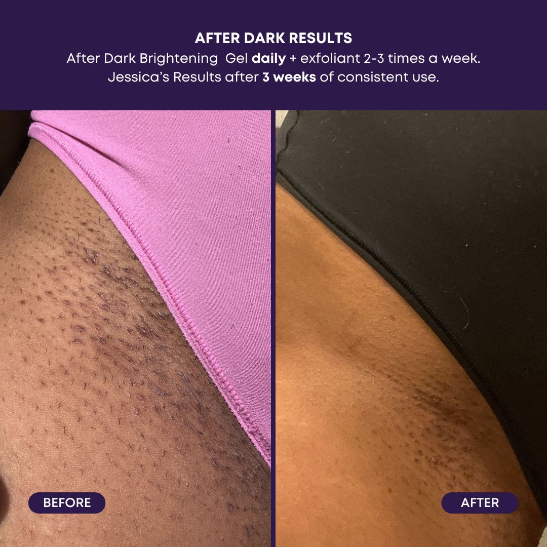 After Dark Brightening Gel P0