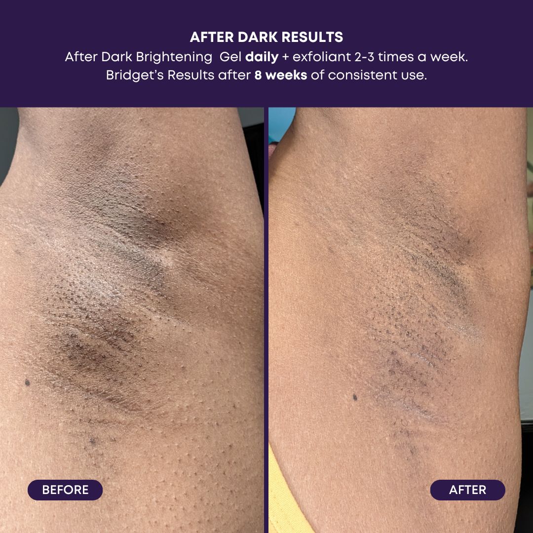 After Dark Brightening Gel P0