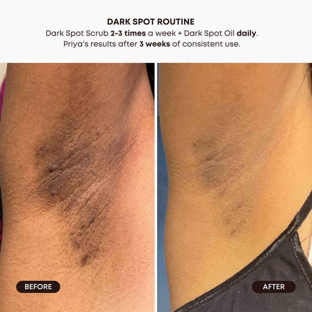 Dark Spot 2 Step Routine - Lavender Lemon V9