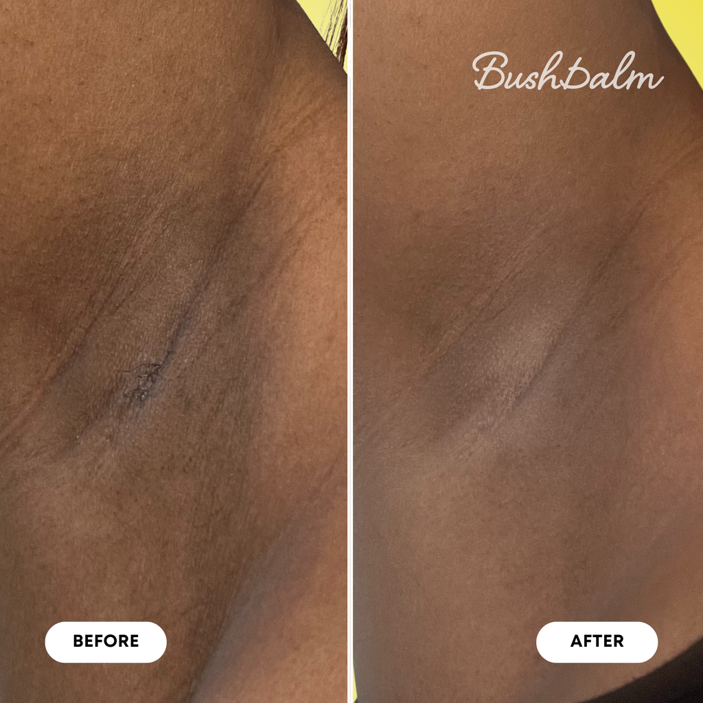 Dark Spot Exfoliating Scrub - Bermuda L3